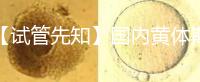 【試管先知】國內黃體期方案經(jīng)驗緊缺,2點促排弊端需了解