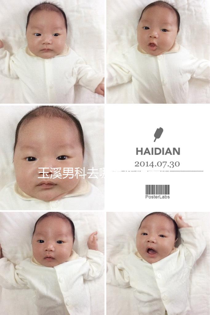 玉溪男科去哪家醫(yī)院看好，怎么選攻略，這個排行榜不要錯過