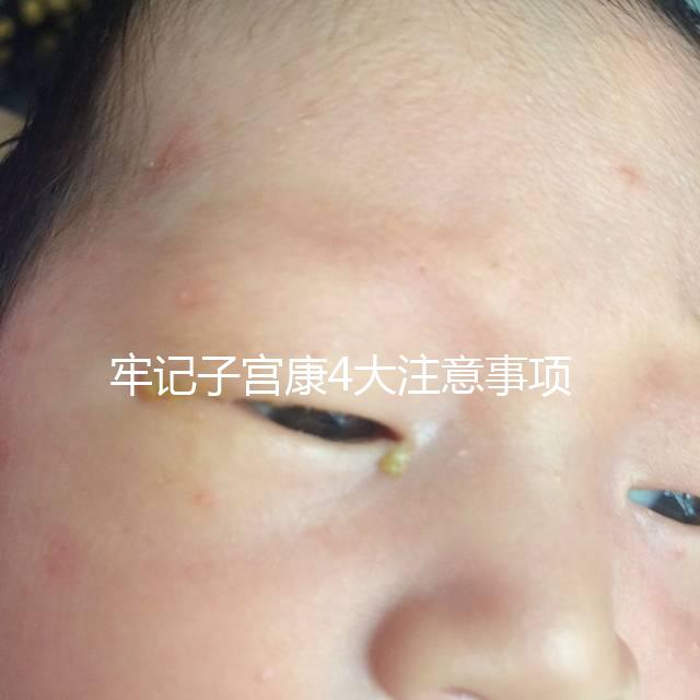 牢記子宮康4大注意事項，輕松避免胃脹、腹瀉等副作用