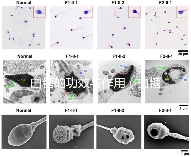白糖的功效與作用（白糖的功效與作用及營養(yǎng)價值）