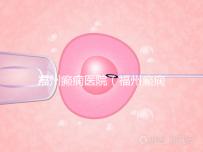 福州癲癇醫院（福州癲癇醫院在哪里）