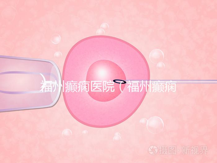 福州癲癇醫(yī)院(福州癲癇醫(yī)院在哪里)