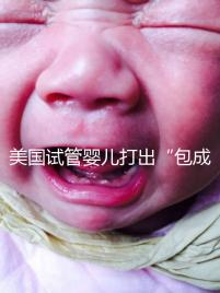 美國(guó)試管嬰兒打出“包成功”靠譜嗎?看完其中套路你就知道