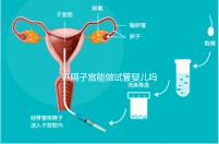 縱隔子宮能做試管嬰兒嗎?醫生:可以做，但要手術治療再進周