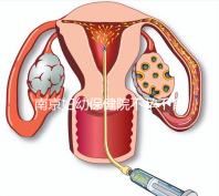 南京婦幼保健院不孕不育醫生排名匯總，掛哪個好一目了然