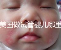 去美國(guó)做試管嬰兒哪里最好,4家好評(píng)輔助生殖機(jī)構(gòu)推薦