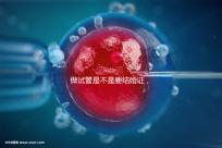 做試管是不是要結婚證,做試管需要結婚證