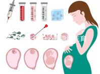 辦準生證沒必要隱瞞生育史,女方再婚需帶離婚證