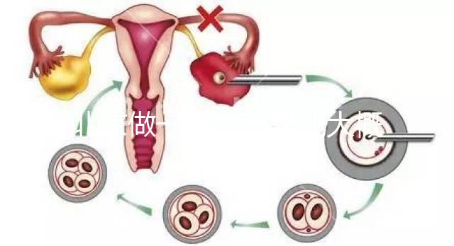 北京做一次試管嬰兒大概花多少錢(qián)?2025年價(jià)格及明細(xì)清單一覽!