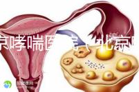 北京哮喘醫院（北京哮喘醫院哪家好）