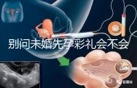 別問未婚先孕彩禮會不會少了，一分不給也不無可能