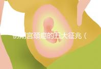 初期宮頸癌的五大征兆（宮頸癌的前兆癥狀）