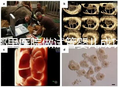 哪里醫院做試管嬰兒成功率高(一代試管成功率有多高)