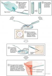 國內首起試管嬰兒案例，法律竟難以給患者維權