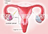 在福建泉州哪家醫院做試管嬰兒好