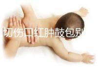 側(cè)切傷口紅腫鼓包別擔(dān)心,分階段和步驟教你護(hù)理