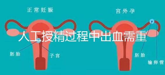人工授精過程中出血需重視!這3種情況會影響成功率