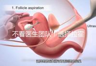 不看醫生團隊！選擇拉霍亞試管嬰兒中心的優勢還有這些