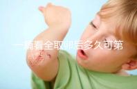 一篇看全取卵后多久可第二次促排卵和移植,做試管的進(jìn)