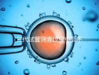 三代試管篩查過(guò)程中會(huì)不會(huì)出現(xiàn)錯(cuò)誤戳,看完流程就知道