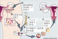 三代試管一般都是男孩嗎(三代試管一般都是男孩嗎還是女孩)