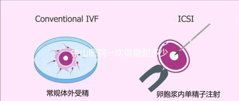 中山醫院一次做糖耐多少錢？你想預約專家嗎？