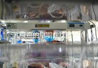 乳腺癌的早期癥狀圖片(乳頭瘤圖片+早期癥狀)