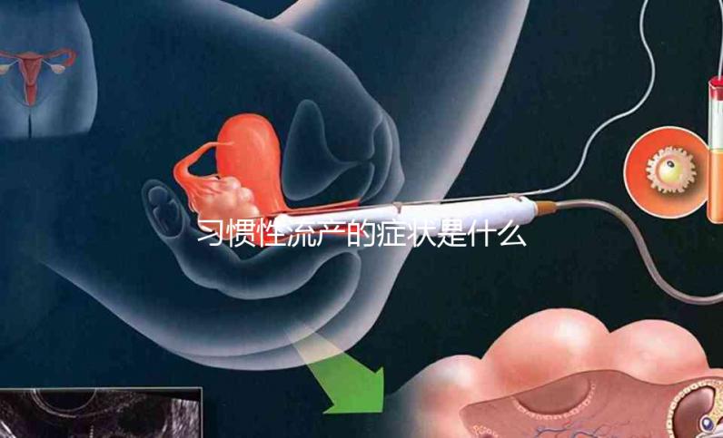 習慣性流產的癥狀是什么？