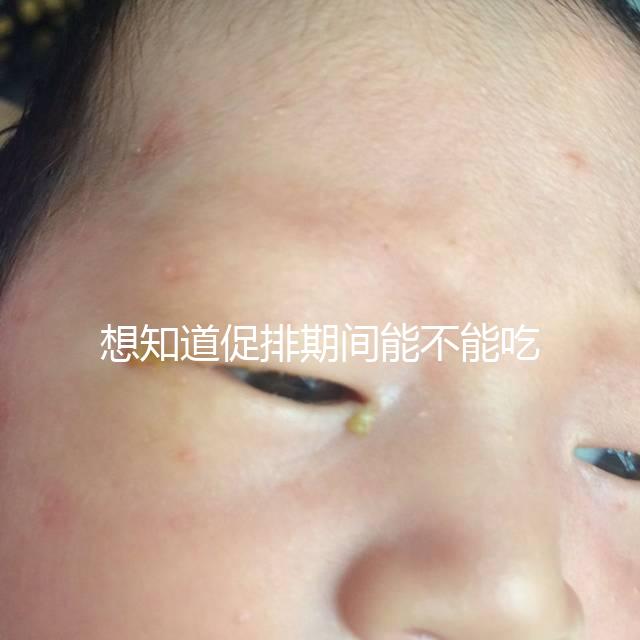 想知道促排期間能不能吃草莓看過(guò)來(lái)，怎么吃不發(fā)胖有講究