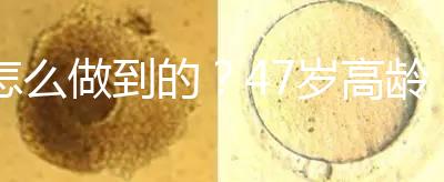 怎么做到的？47歲高齡試管嬰兒唯一男胚一次移植成功！