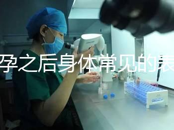 懷孕之后身體常見的表現是什么