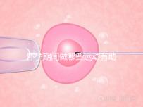 懷孕期間做哪些運動有助于自然分娩？