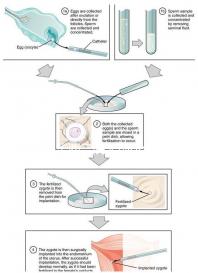 成都華西二院無創dna價格來了，2024想造哪里能免費做看這