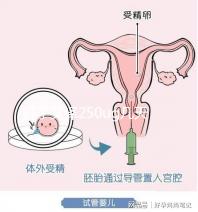 打了艾澤250ug幾天能代謝完戳，第十天別還不敢走下一步