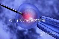 打一針60mg黃體酮催經不管用？下個月肌注三針20mg看看