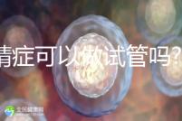 死精癥可以做試管嗎?醫生:死精子達97%都有成功的可能