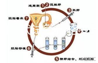 泰國三代試管價格變動，2025年最新費用行情一覽