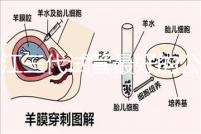 浙江三代試管最好的公立醫院推薦，參考性大隨你挑