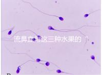 流鼻血與這三種水果的“奇妙”關系,建議少吃,多補充維生素K可以幫助止血!