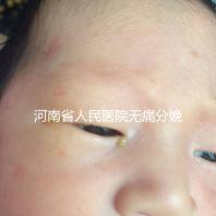 河南省人民醫(yī)院無(wú)痛分娩多少錢戳,收費(fèi)標(biāo)準(zhǔn)60s看懂不踩坑