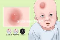 淄博男科醫(yī)院排名表來(lái)了2024年哪個(gè)口碑好?網(wǎng)友怎么說?