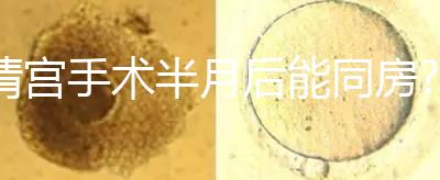 清宮手術(shù)半月后能同房?別盲目相信,聽(tīng)醫(yī)生咋說(shuō)!