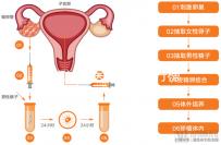 湛江試管醫院前十排行榜，久和醫院vs廣醫附院誰好一覽了然