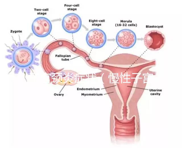 子宮頸炎癥狀（慢性子宮頸炎癥狀）