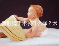 宮腔鏡手術(shù)長(zhǎng)什么樣？術(shù)后要注意什么？ ?