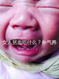 女人貧血吃什么?補(bǔ)氣養(yǎng)血,掌握這五個(gè)技巧,讓你煥發(fā)青春光彩