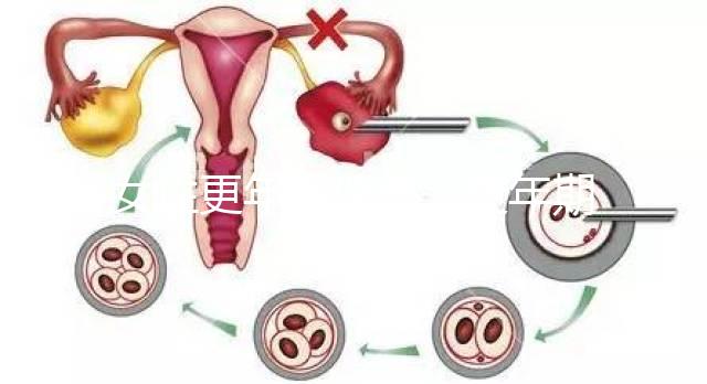 女性更年期保?。ǜ昶趮D女保健健康宣教）