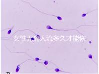 女性無(wú)痛人流多久才能恢復(fù)健康?