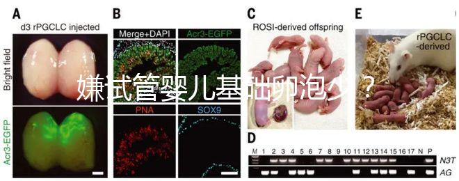 嫌試管嬰兒基礎卵泡少？并非只能食療，這份增多錦囊請收下