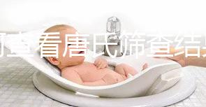 如何查看唐氏篩查結(jié)果，珠海醫(yī)院價(jià)格二百四起